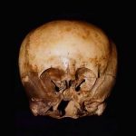 Cranio-Starchild-Starchild-Skull